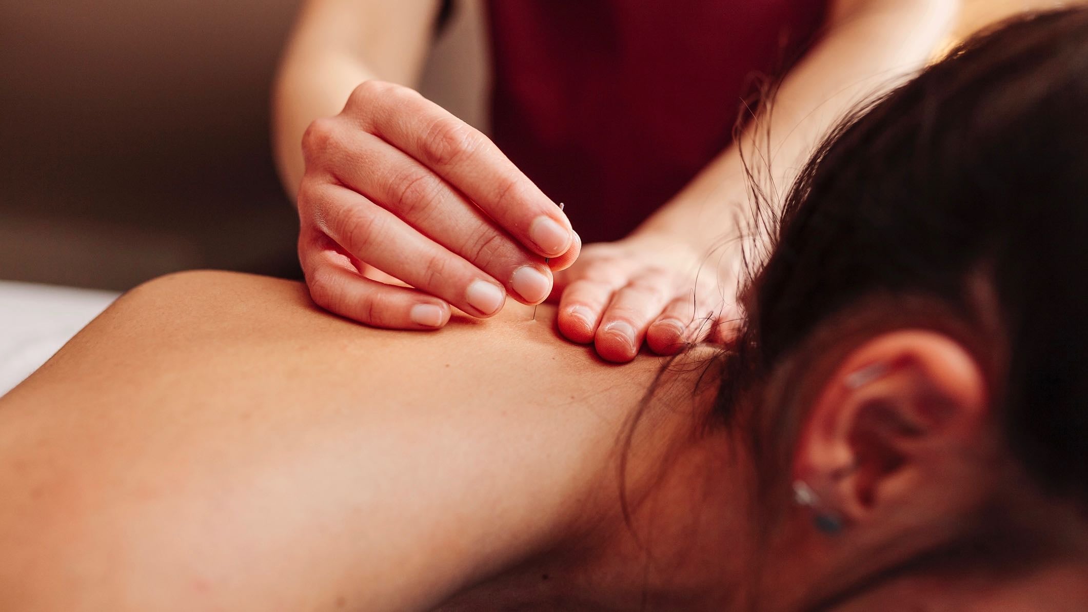 Dry needling is a pain management technique used around the world.