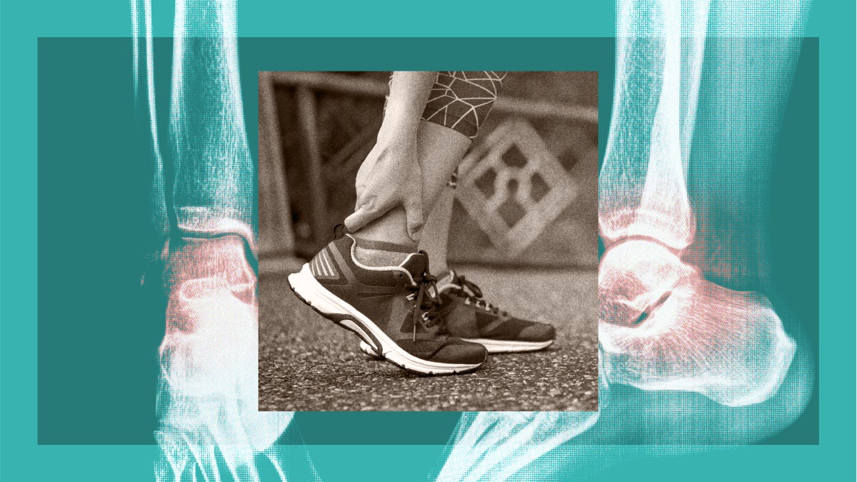 The Most Common Injuries for New Triathletes (and How to Treat Them Yourself)