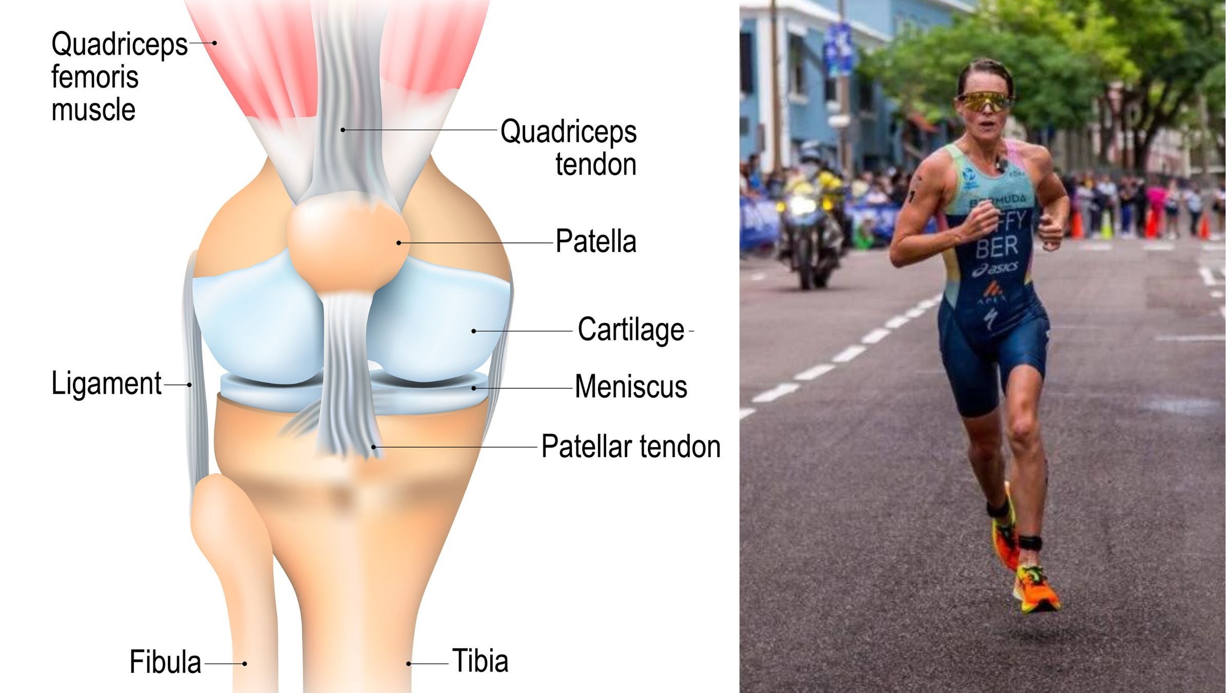 A photo fo Flora Duffy running alongside a diagram of Patellar Tendinopathy