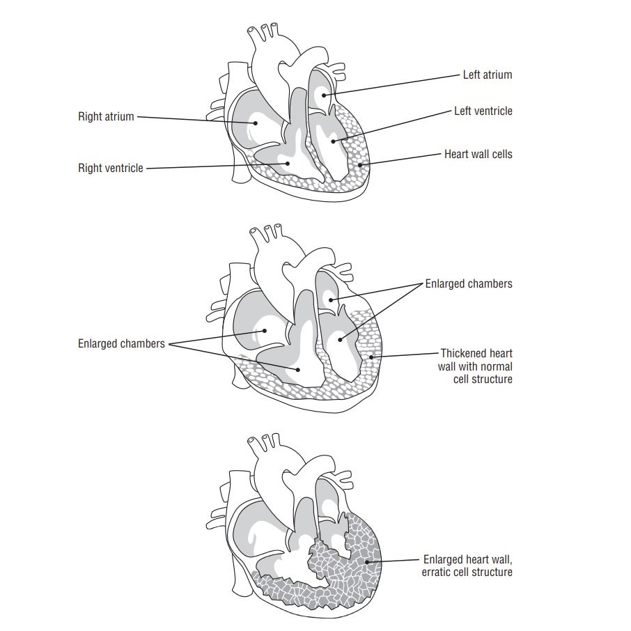 Illustration of 3 different hearts